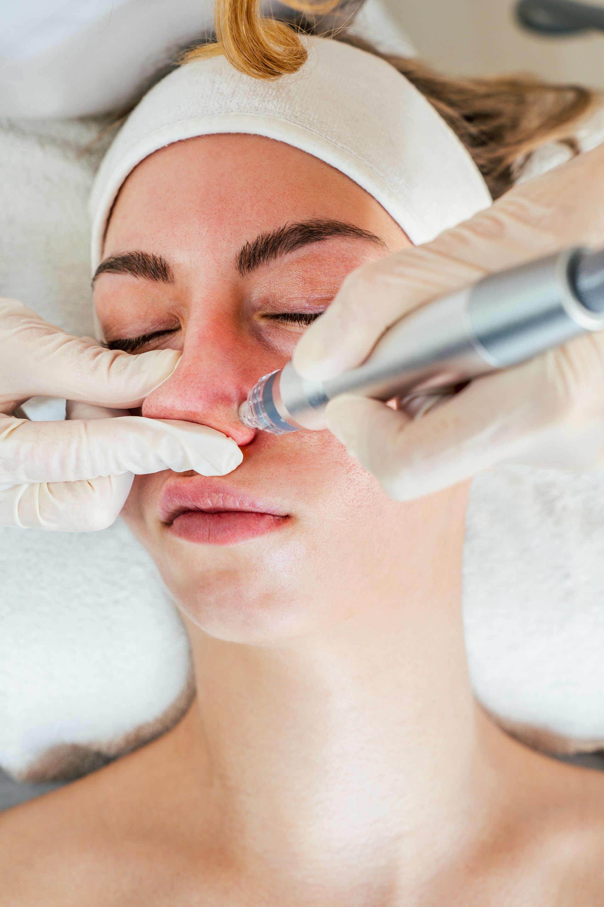 Woman receiving facial treatment, eyes closed. Hands with gloves use a device on her nose.