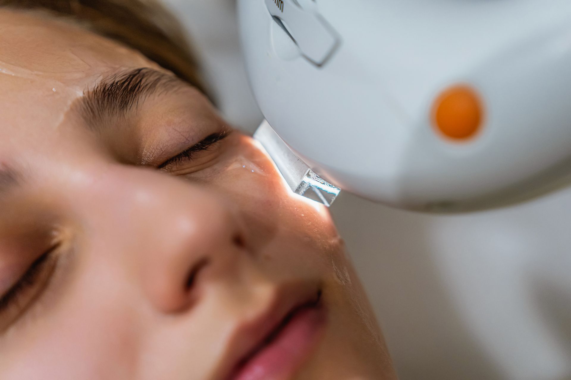 Woman's face receiving a laser treatment on her cheek in a medical setting.