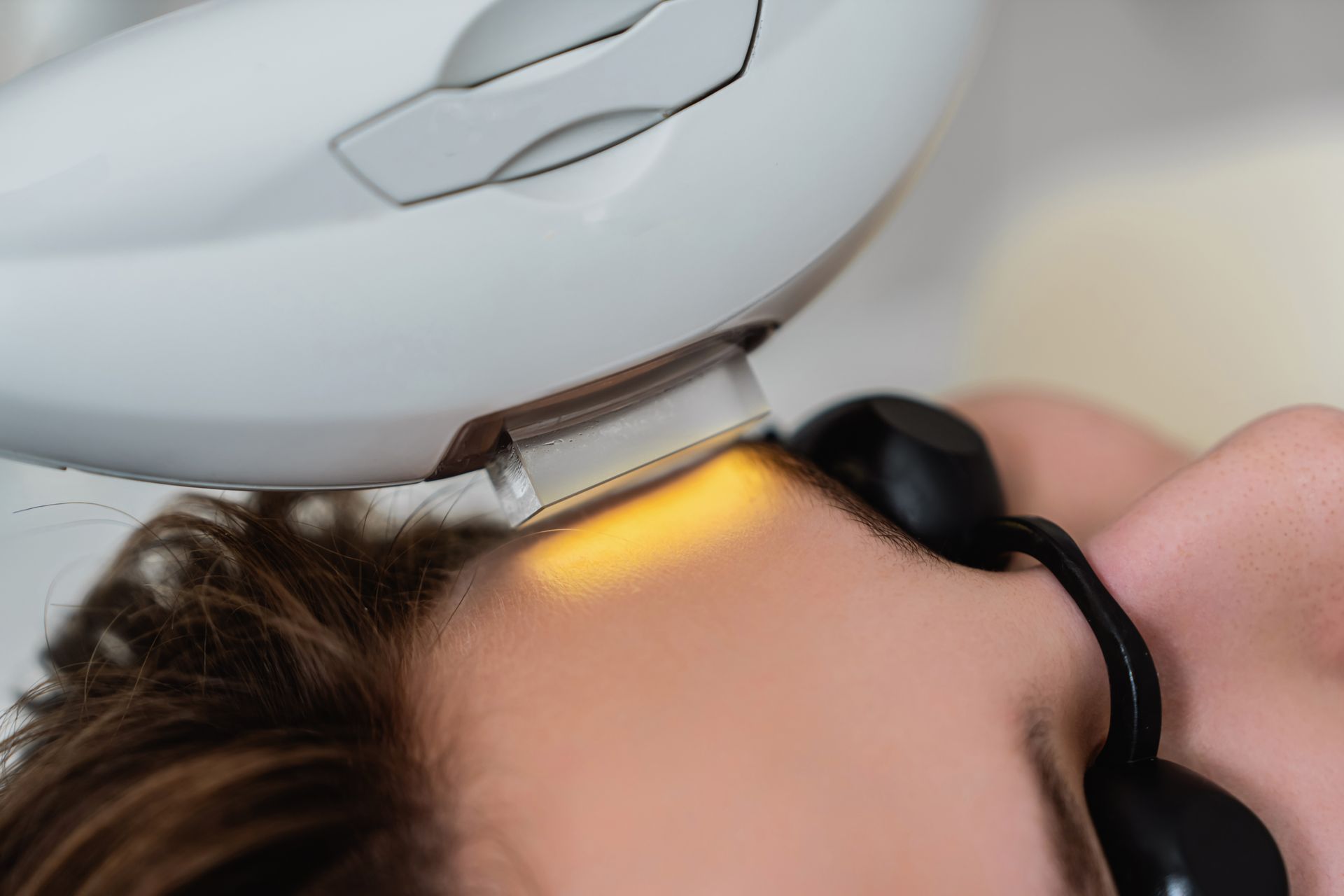 A person undergoing laser hair removal on the forehead, wearing protective eyewear; a light-colored device is used.
