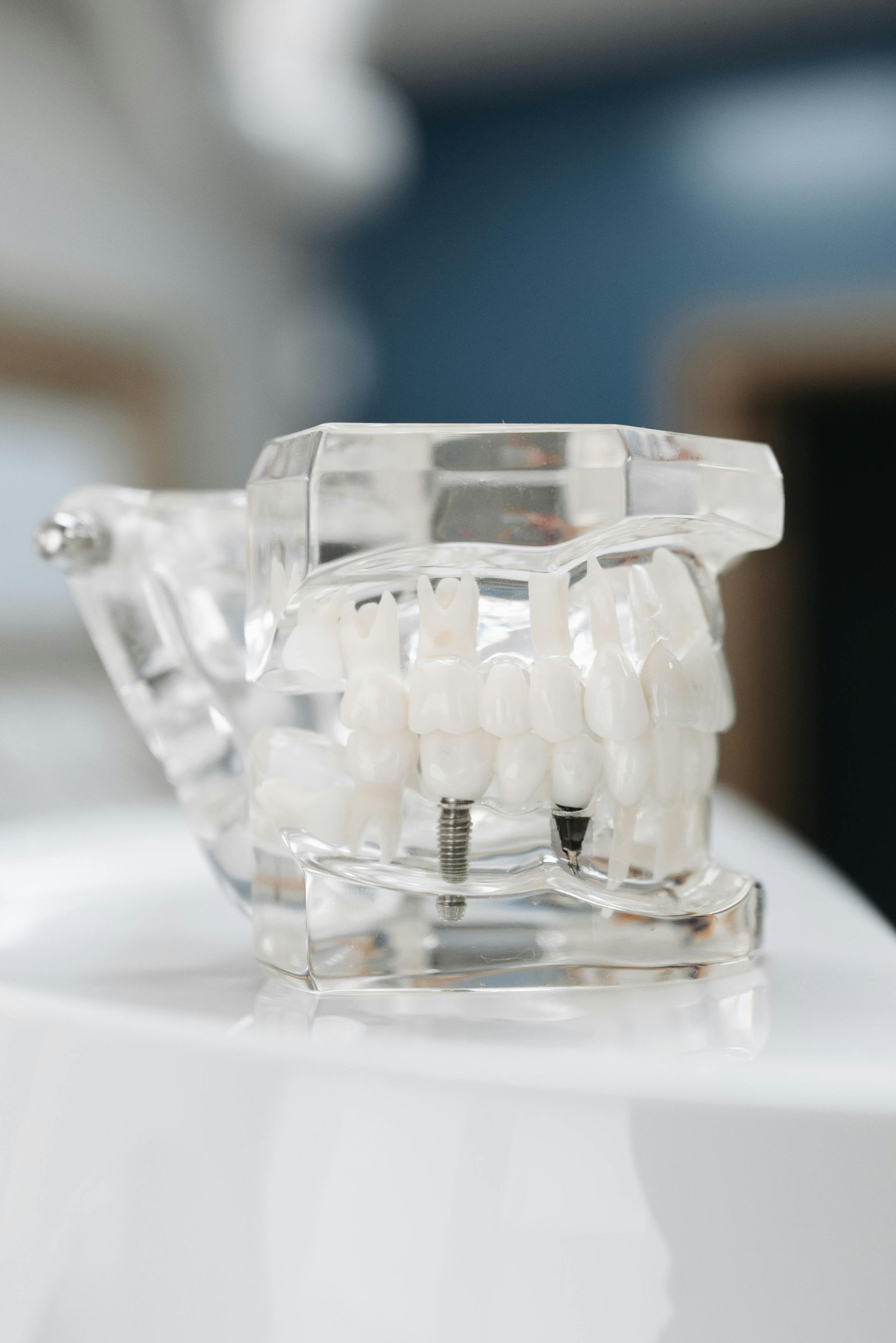 Clear dental aligner on white surface, with a blurred blue background