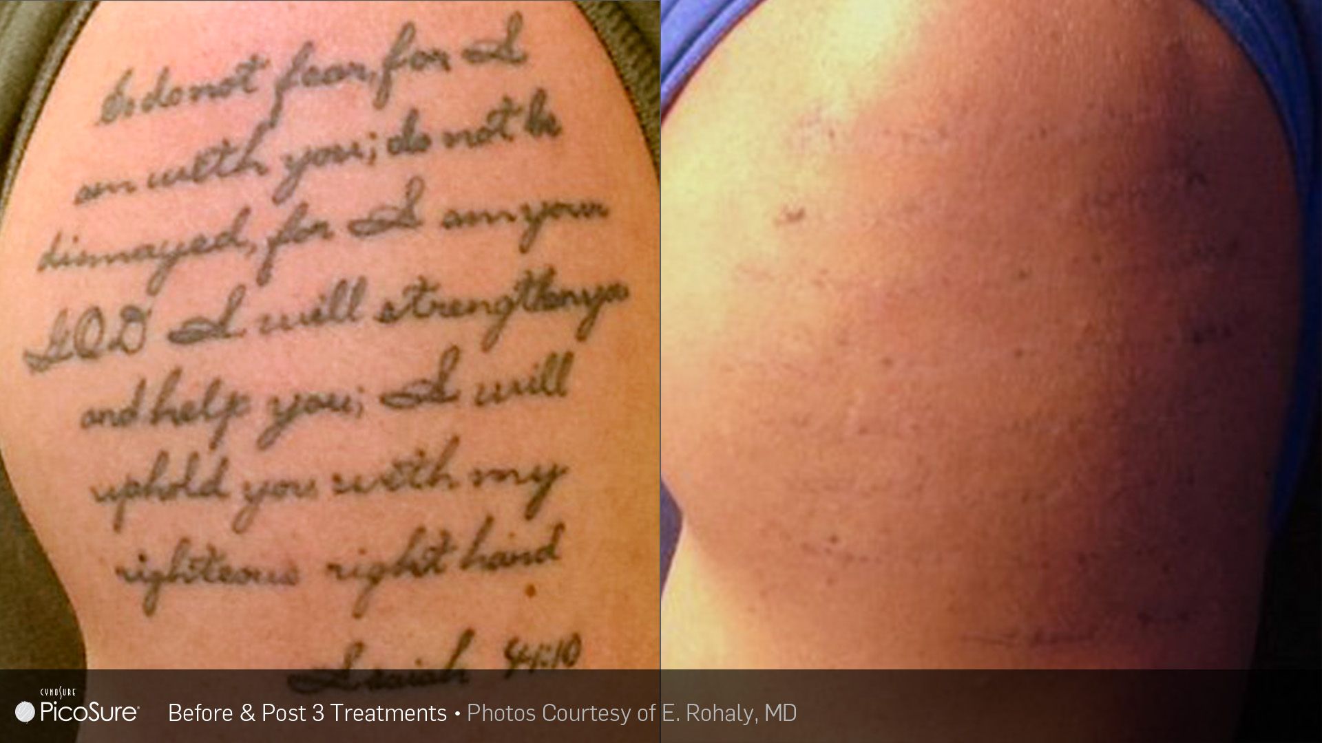A woman has a tattoo on her arm that says do not fear