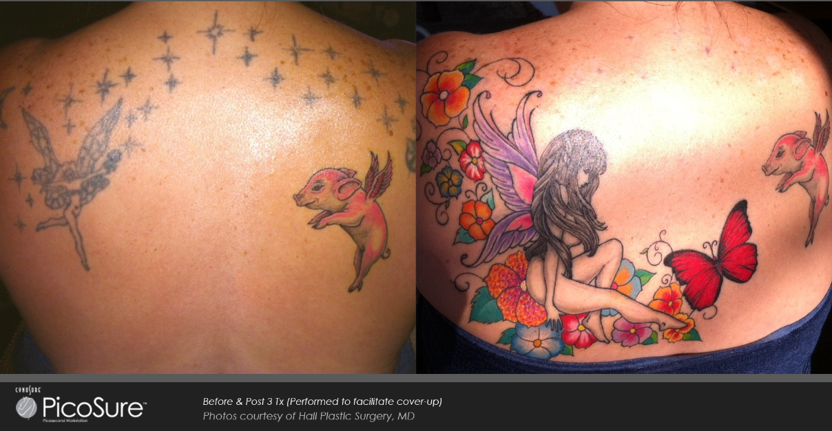 A woman has a tattoo of a fairy on her back