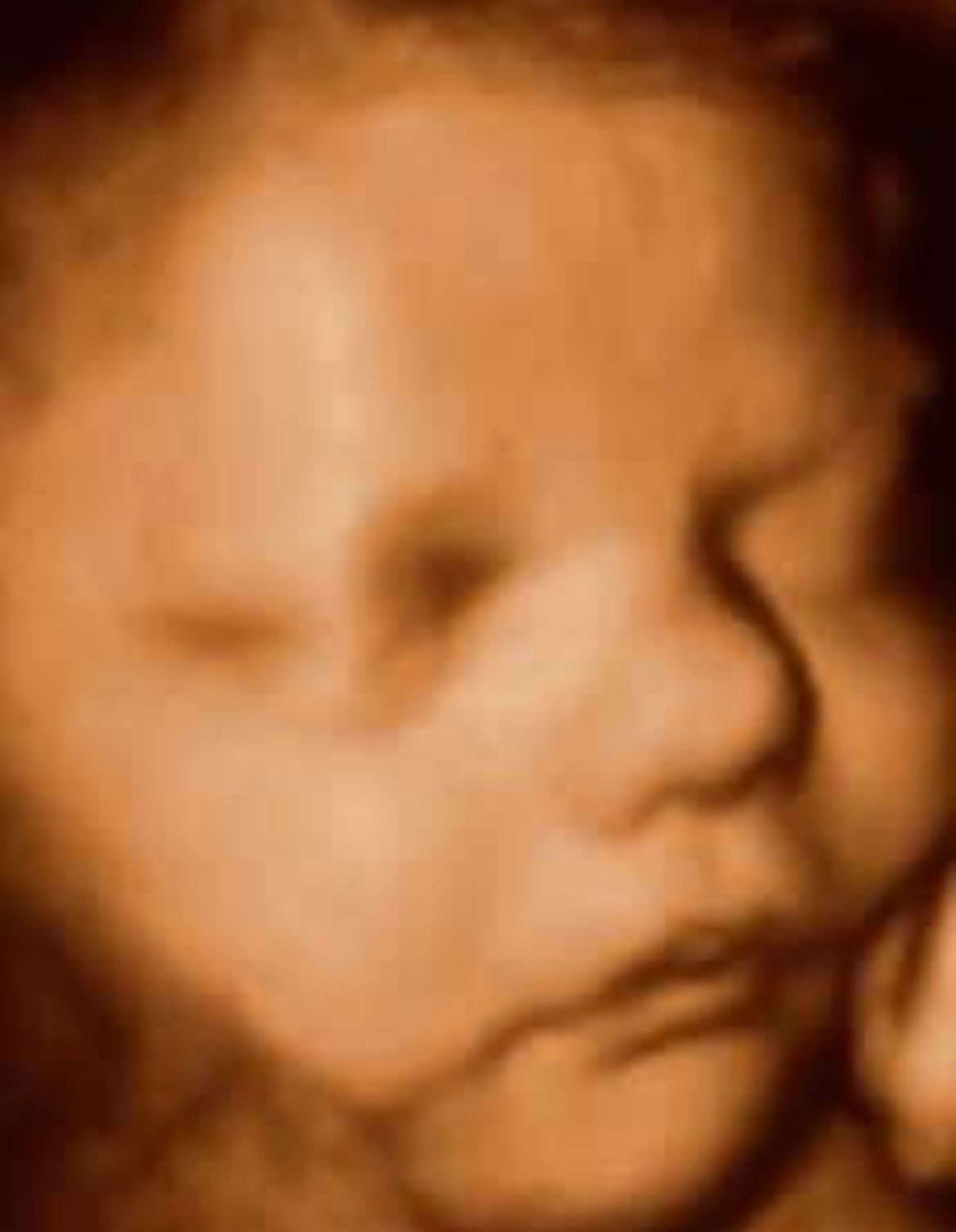 Ultrasound Gallery Greencastle, PA Baby to Be Boutique