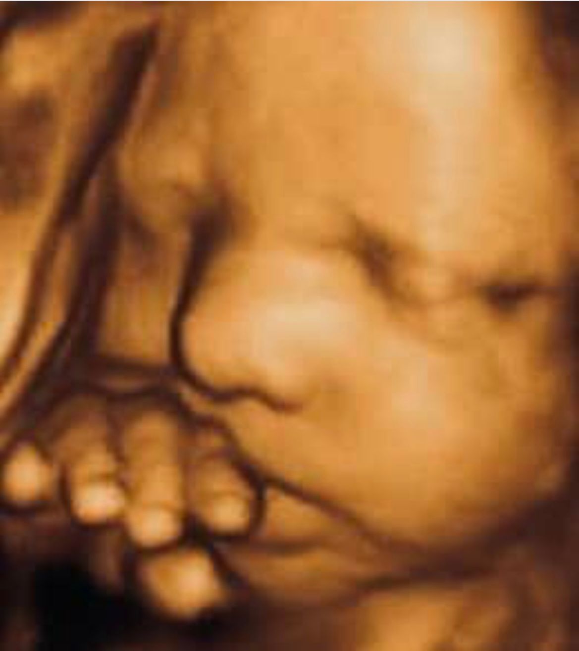 Ultrasound Studio Hagerstown, MD Baby to Be Boutique