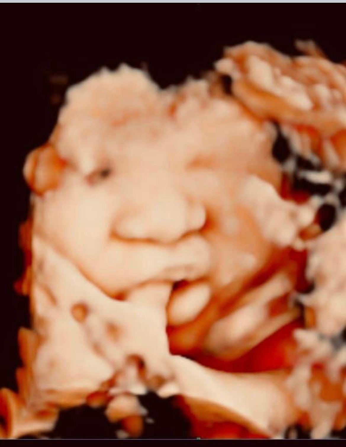 Ultrasound Studio Hagerstown, MD Baby to Be Boutique