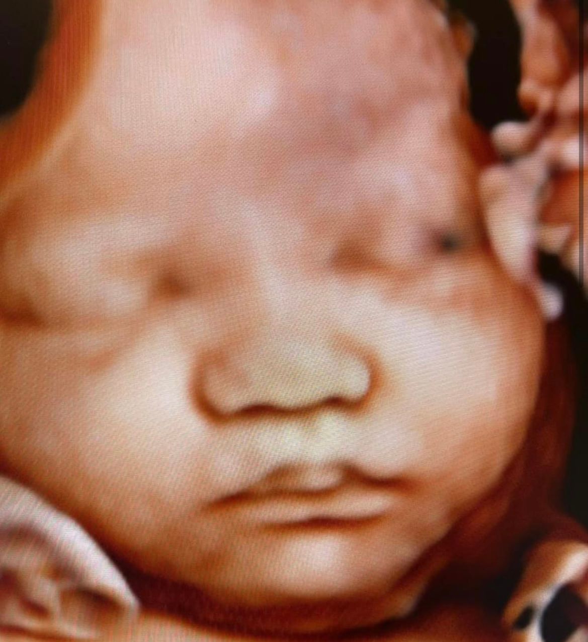 Ultrasound Studio Hagerstown, MD Baby to Be Boutique