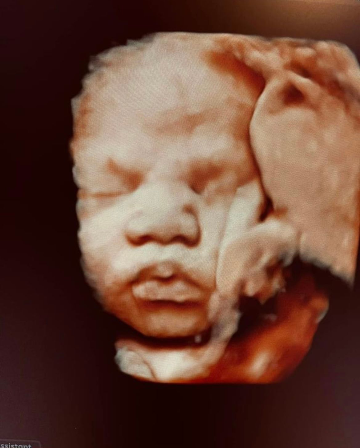 Ultrasound Studio Hagerstown, MD Baby to Be Boutique