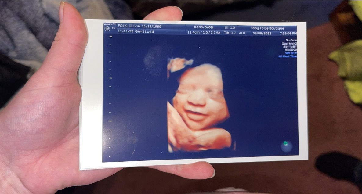 First Baby Smile — Greencastle, PA — Baby to Be Boutique