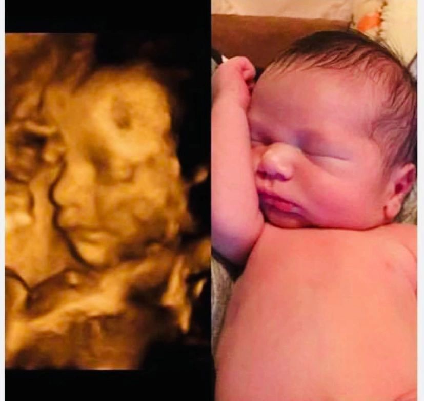 Before and After of Baby — Greencastle, PA — Baby to Be Boutique