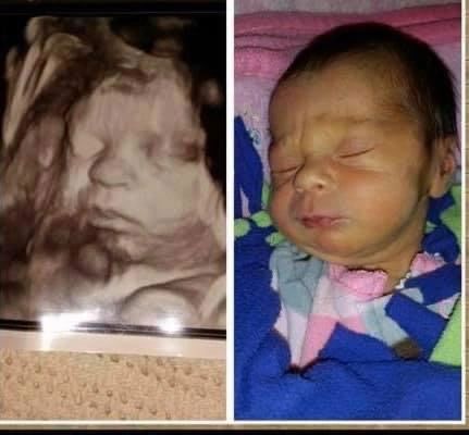 Small Differences on Before and After — Greencastle, PA — Baby to Be Boutique