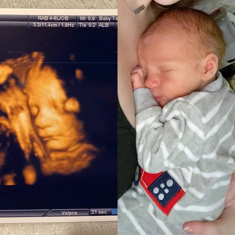 Sleepy Baby Posture — Greencastle, PA — Baby to Be Boutique