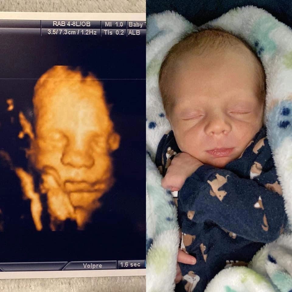 Baby Cute Sleeping Face — Greencastle, PA — Baby to Be Boutique