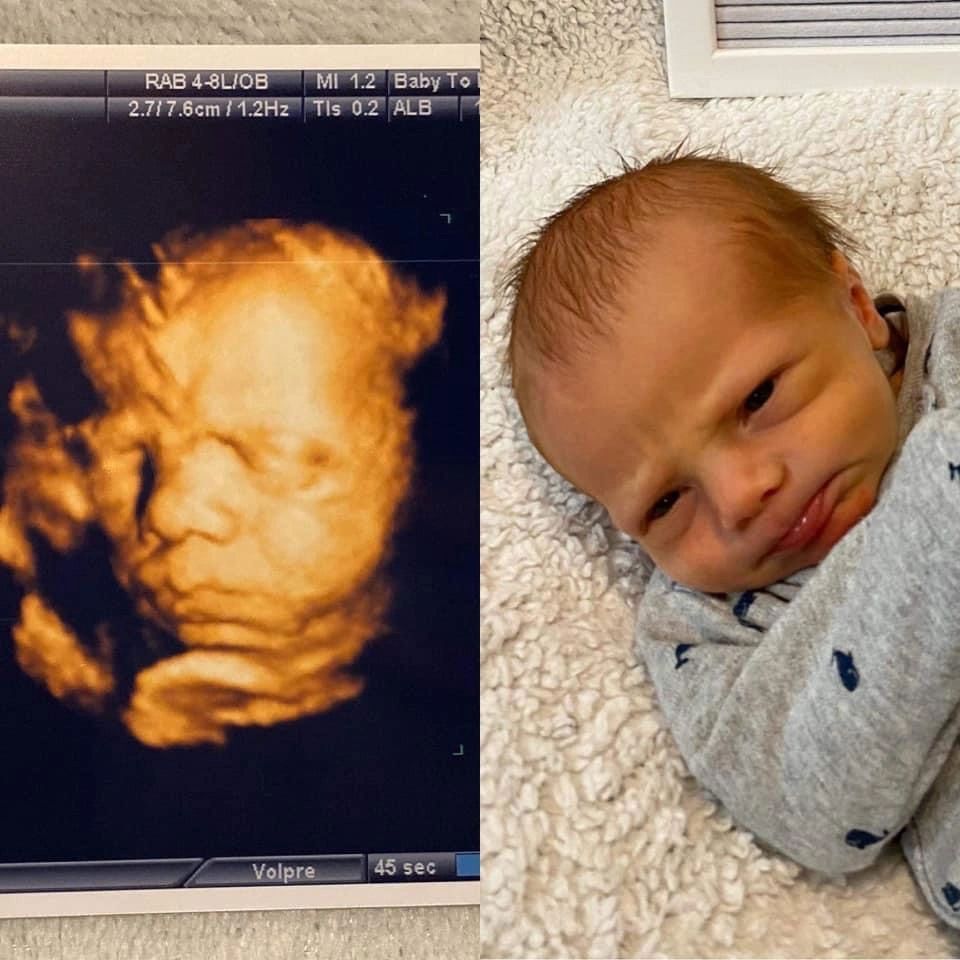Cute Baby About to Cry — Greencastle, PA — Baby to Be Boutique