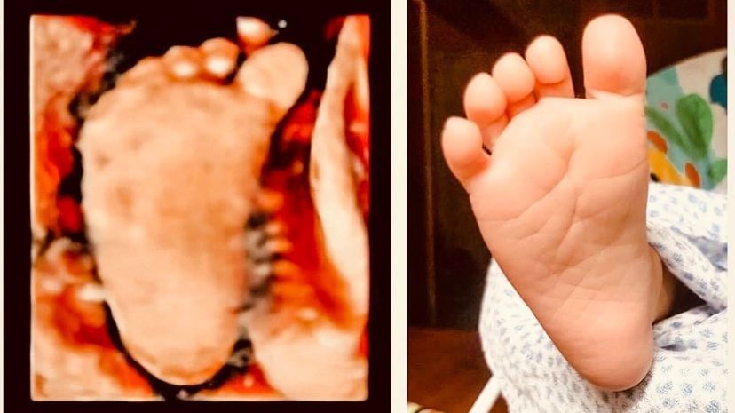 Before and After of Baby Feet — Greencastle, PA — Baby to Be Boutique