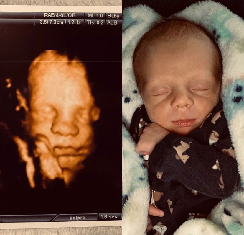 Before and After of Baby Sleeping Face — Greencastle, PA — Baby to Be Boutique