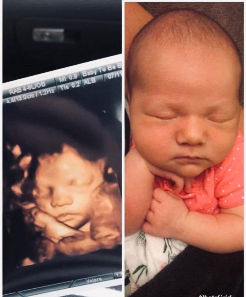 Before and After of Healthy Baby — Greencastle, PA — Baby to Be Boutique