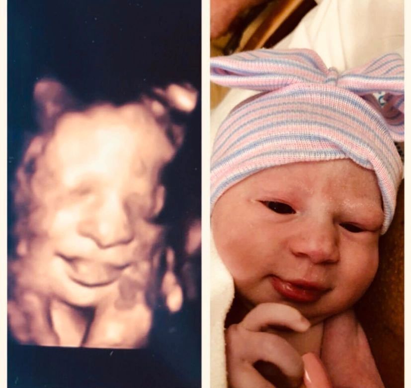 Face Comparison of a Baby — Greencastle, PA — Baby to Be Boutique