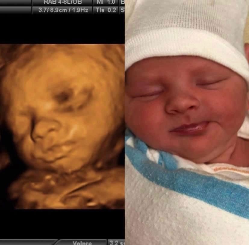 Baby Face Comparison — Greencastle, PA — Baby to Be Boutique