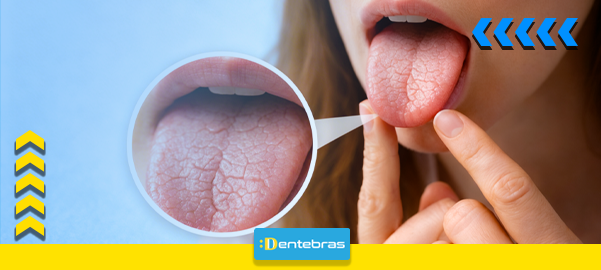 Detalhe da língua e da boca com setas indicando a direção da língua e um pequeno detalhe circular ampliado.