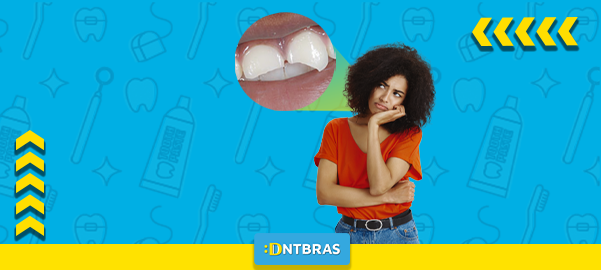 dente quebrado; saúde bucal