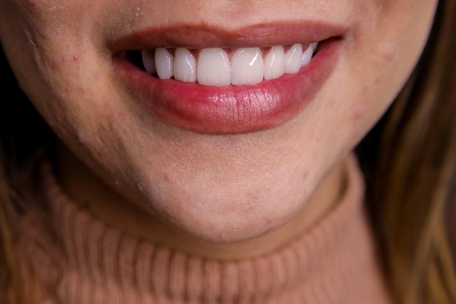 Close-up de uma boca sorridente com dentes brancos visíveis e lábios rosados, vestindo um suéter de gola alta bege.