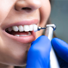 Limpeza dental