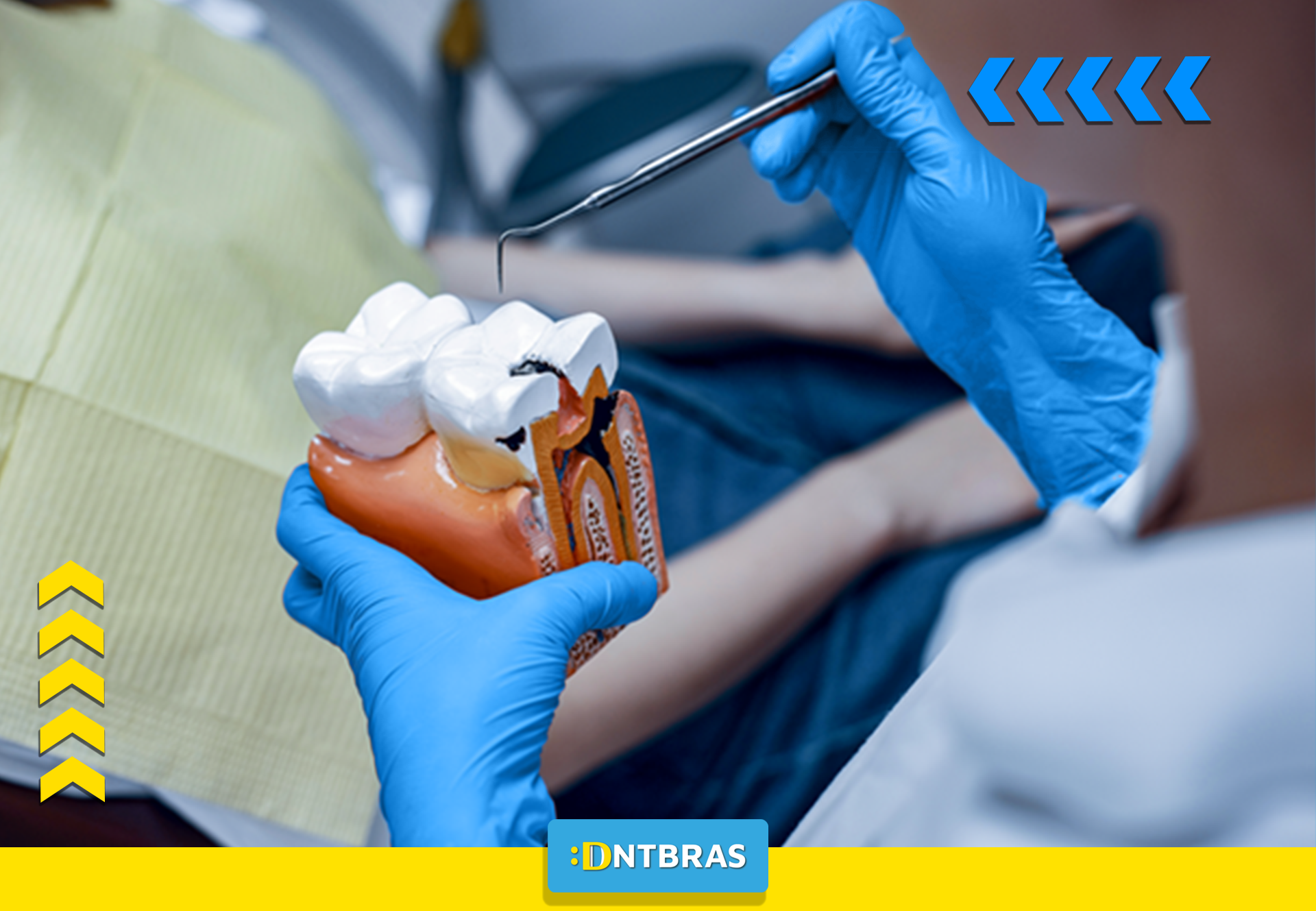um dentista está examinando um modelo de dente com uma broca.