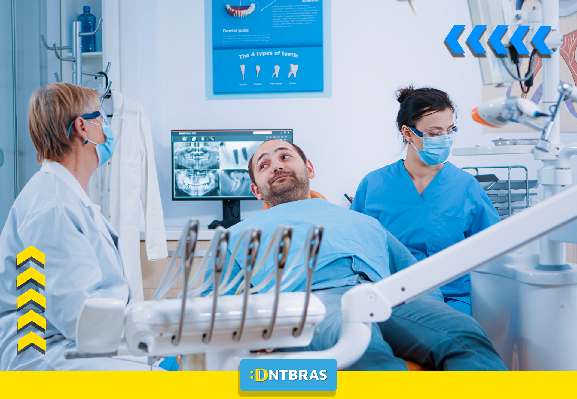 Implantes dentários