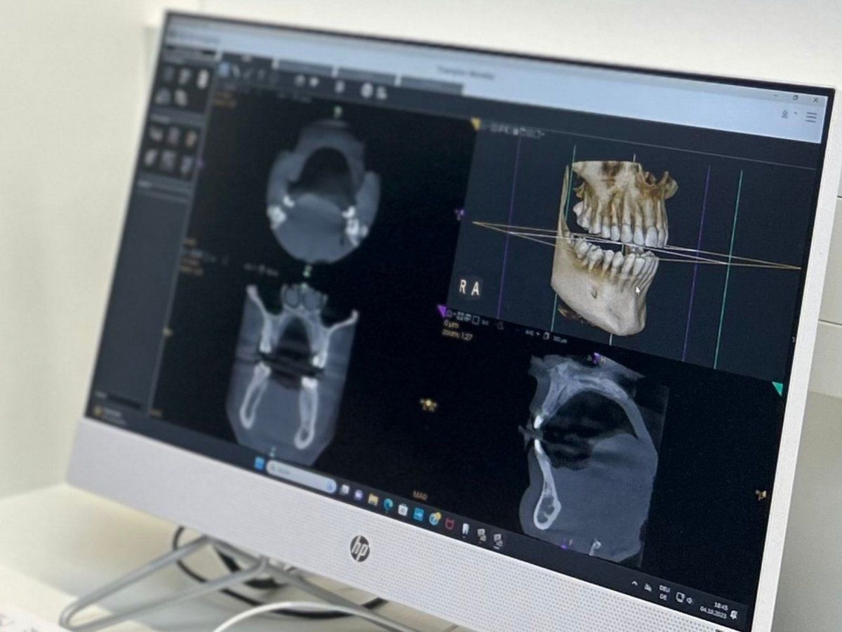Röntgen Zahnärzte in Mödling Brilliant Smiles