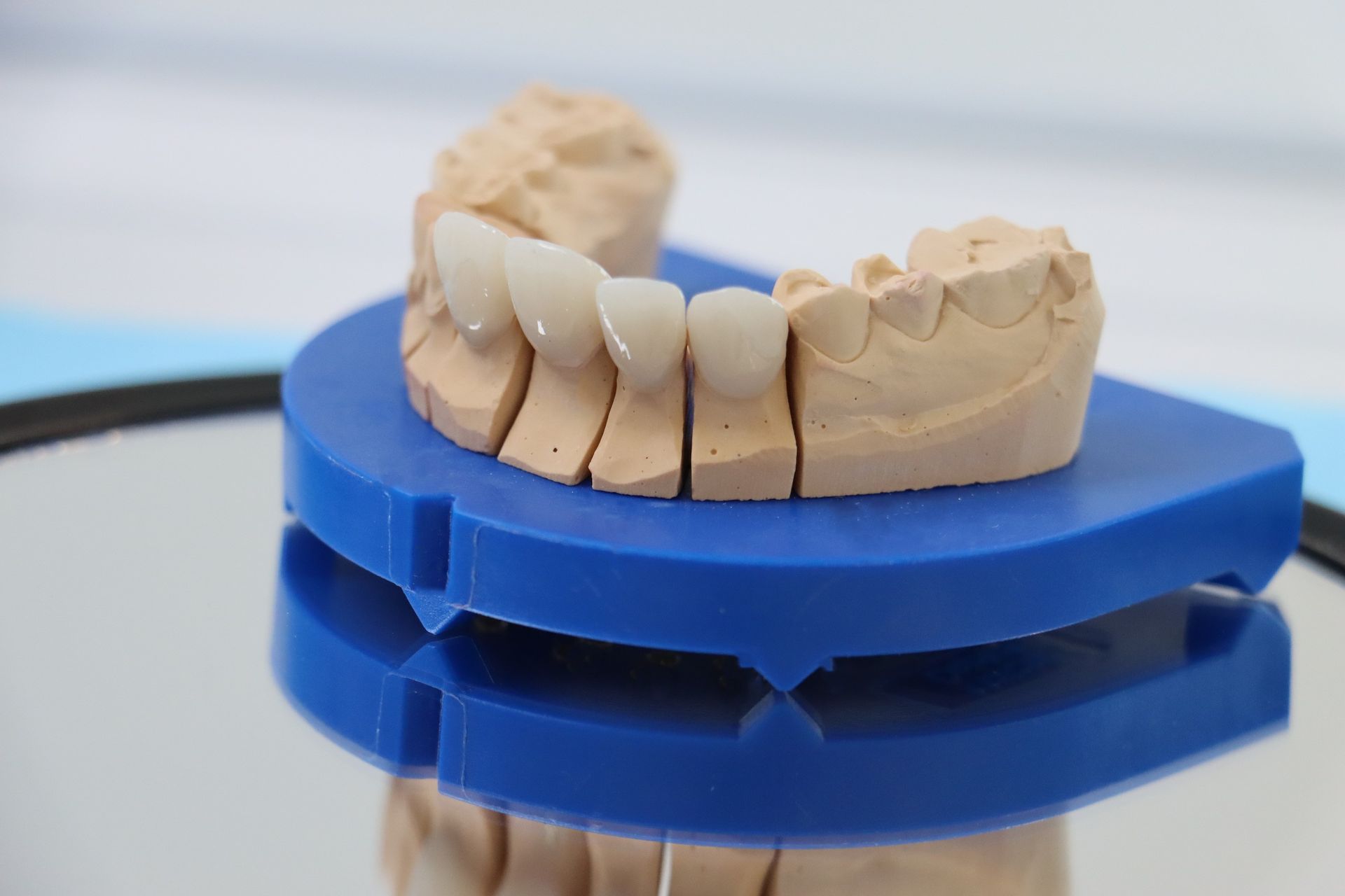 Zahnmodell mit Porzellanveneers auf blauem Grund, verspiegelte Oberfläche.