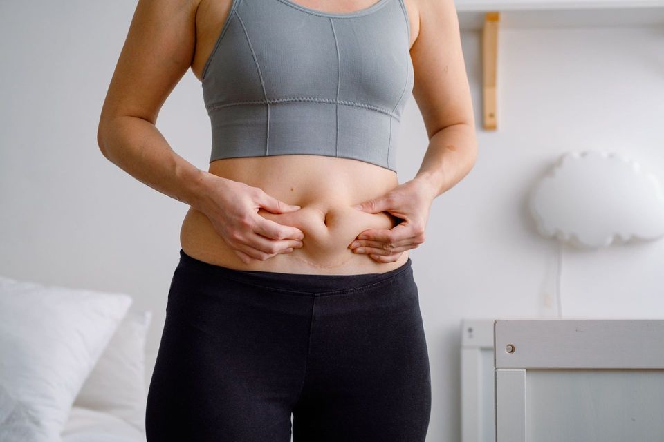Flacidez abdominal