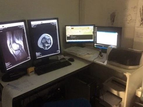 Postazione di lavoro in ufficio scarsamente illuminata con quattro monitor che visualizzano scansioni e referti medici su una scrivania