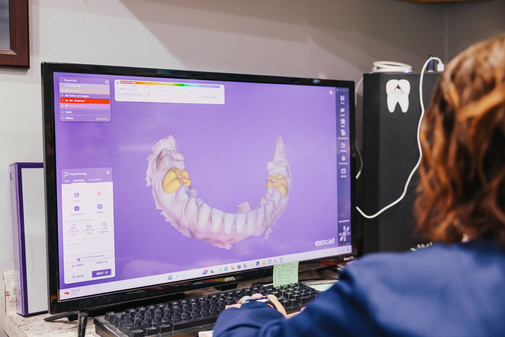 Person at computer analyzes dental scan on screen. Purple interface, black monitor, keyboard.
