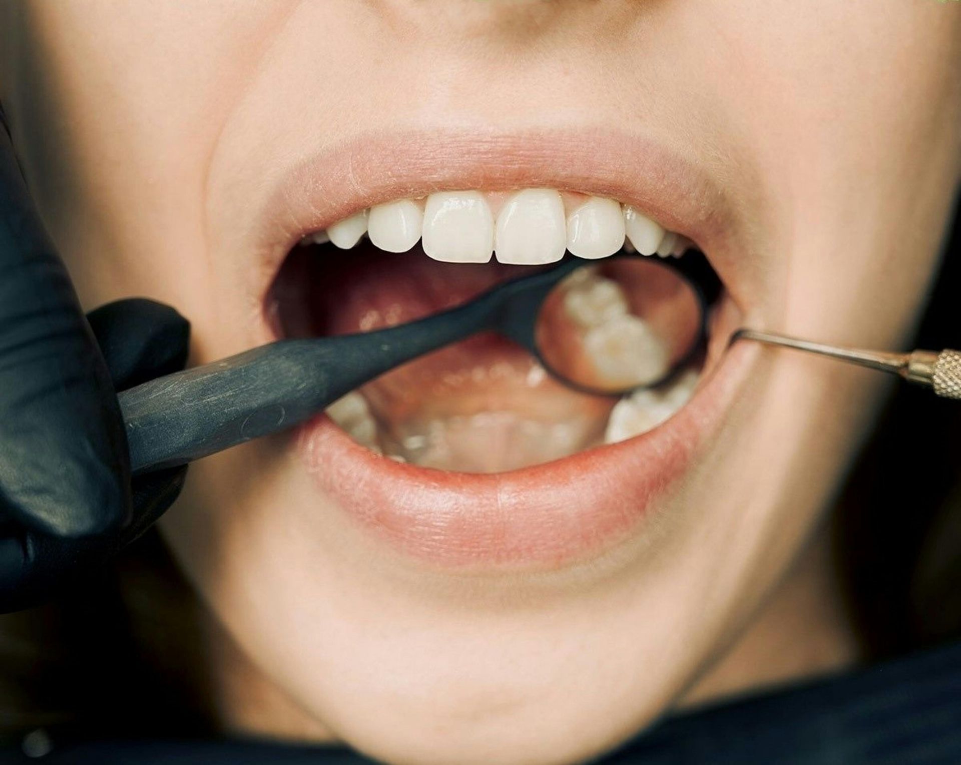 A woman is getting her teeth examined by a dentist.