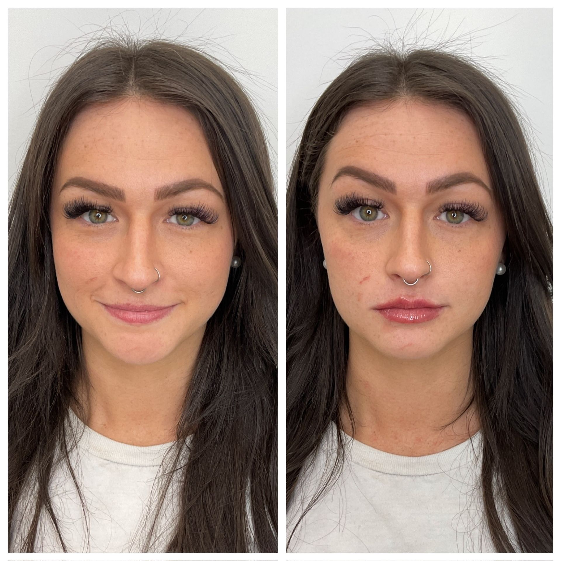 A before and after photo of a woman 's face.