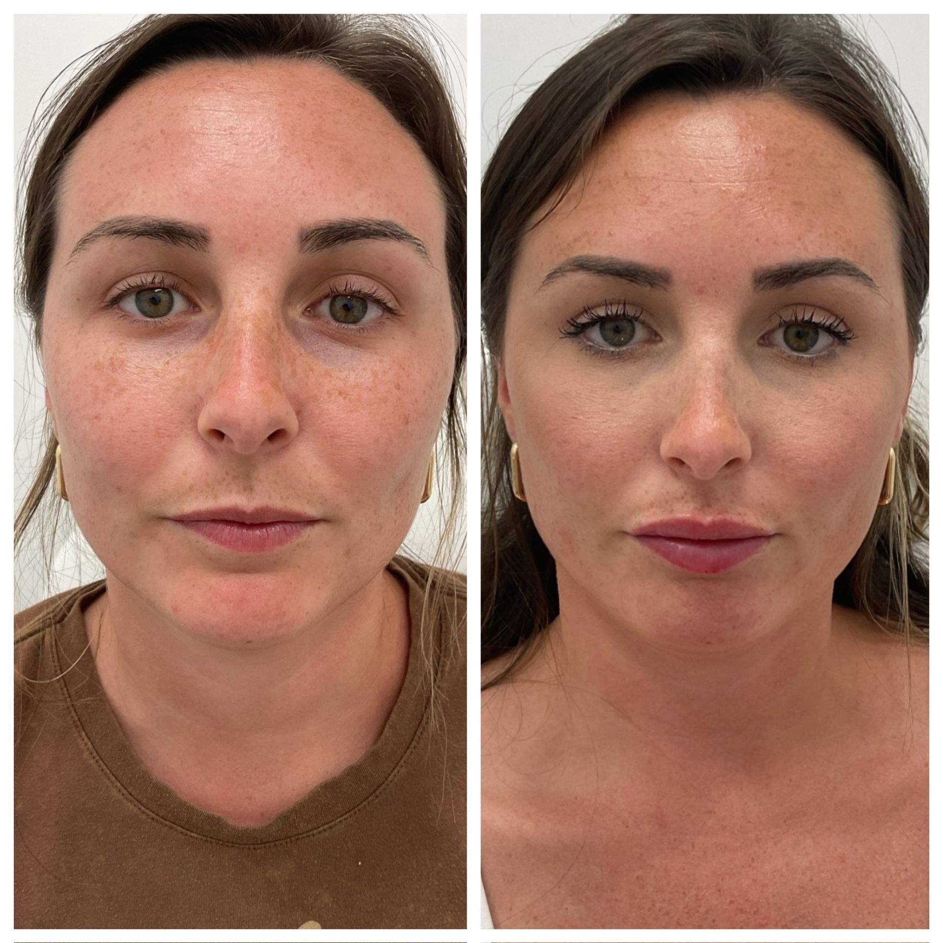 A before and after photo of a woman 's face.
