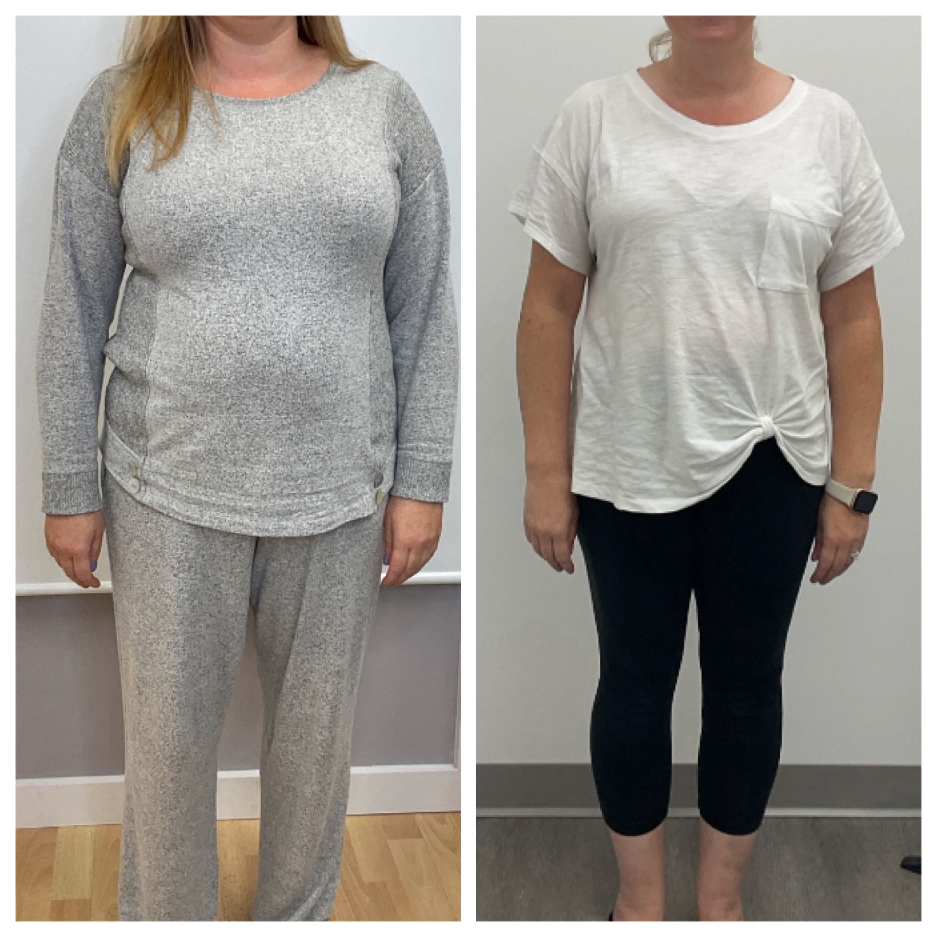 A before and after photo of a woman in pajamas and a white shirt.