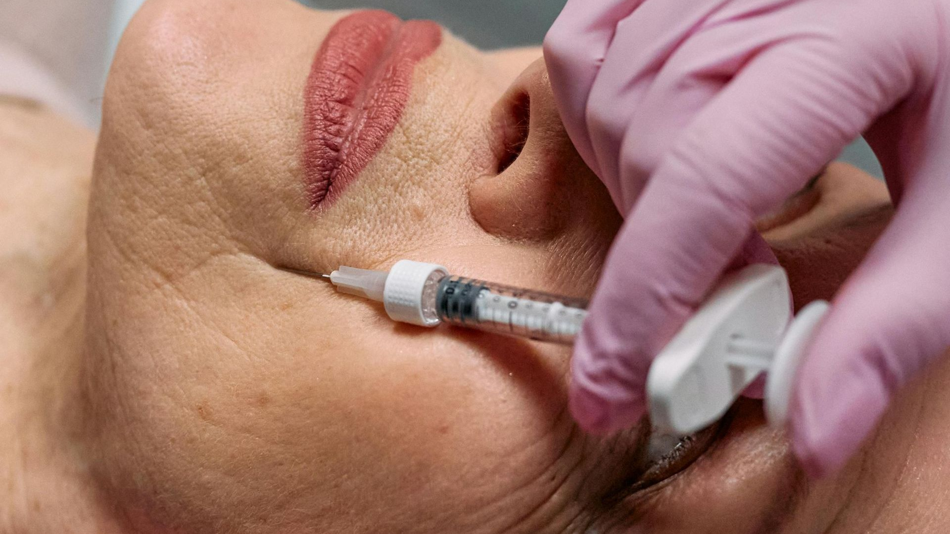 When to Get Botox Before an Event: The Ultimate Timeline