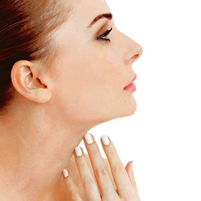 Facelifting