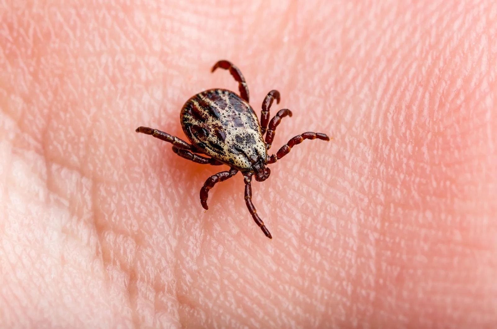 Tick on human skin close-up, showing dark patterned body and legs