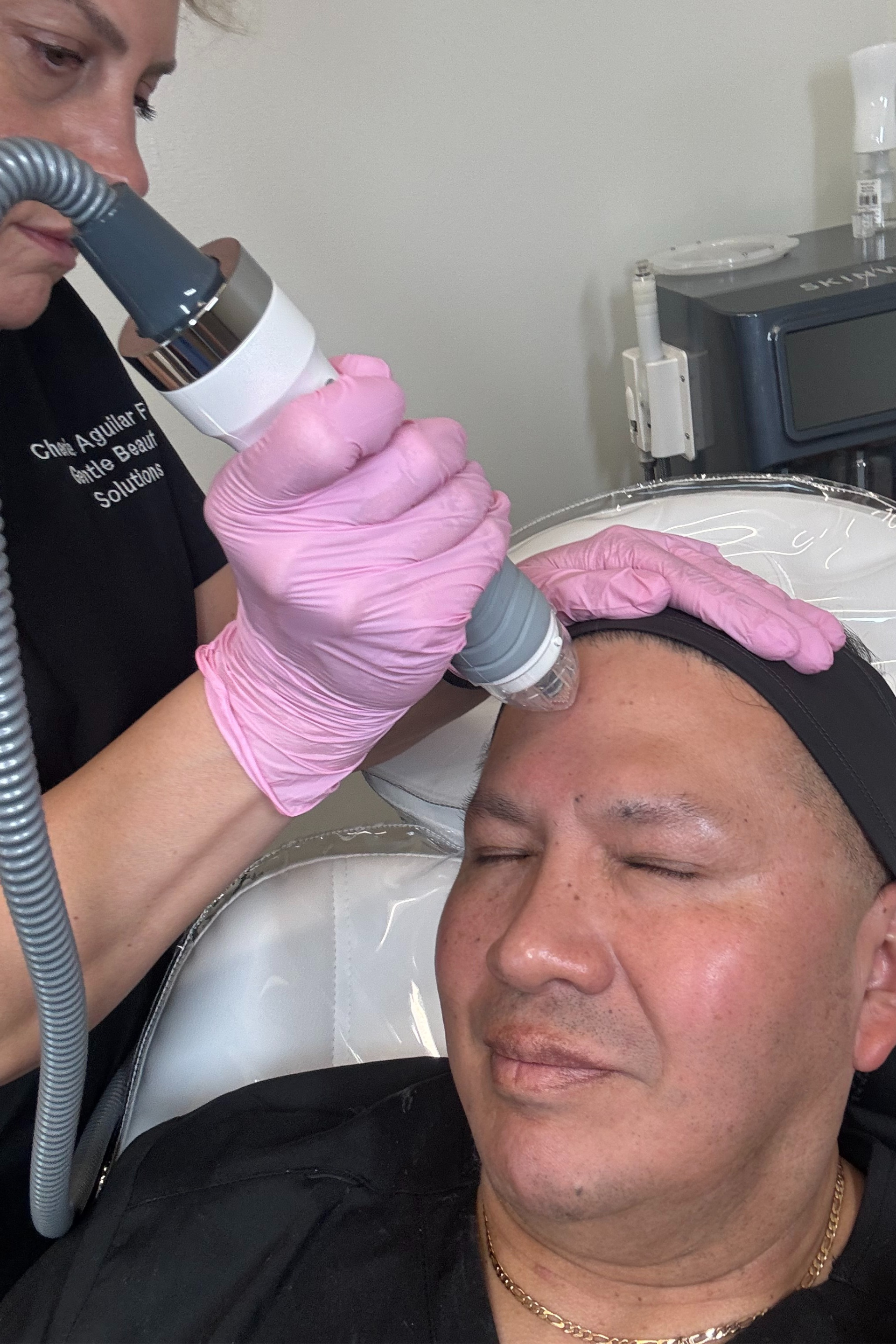 Microneedling inc reases collagen 400%, tightens skin, reduces pore size, giving you a beautiful glow.