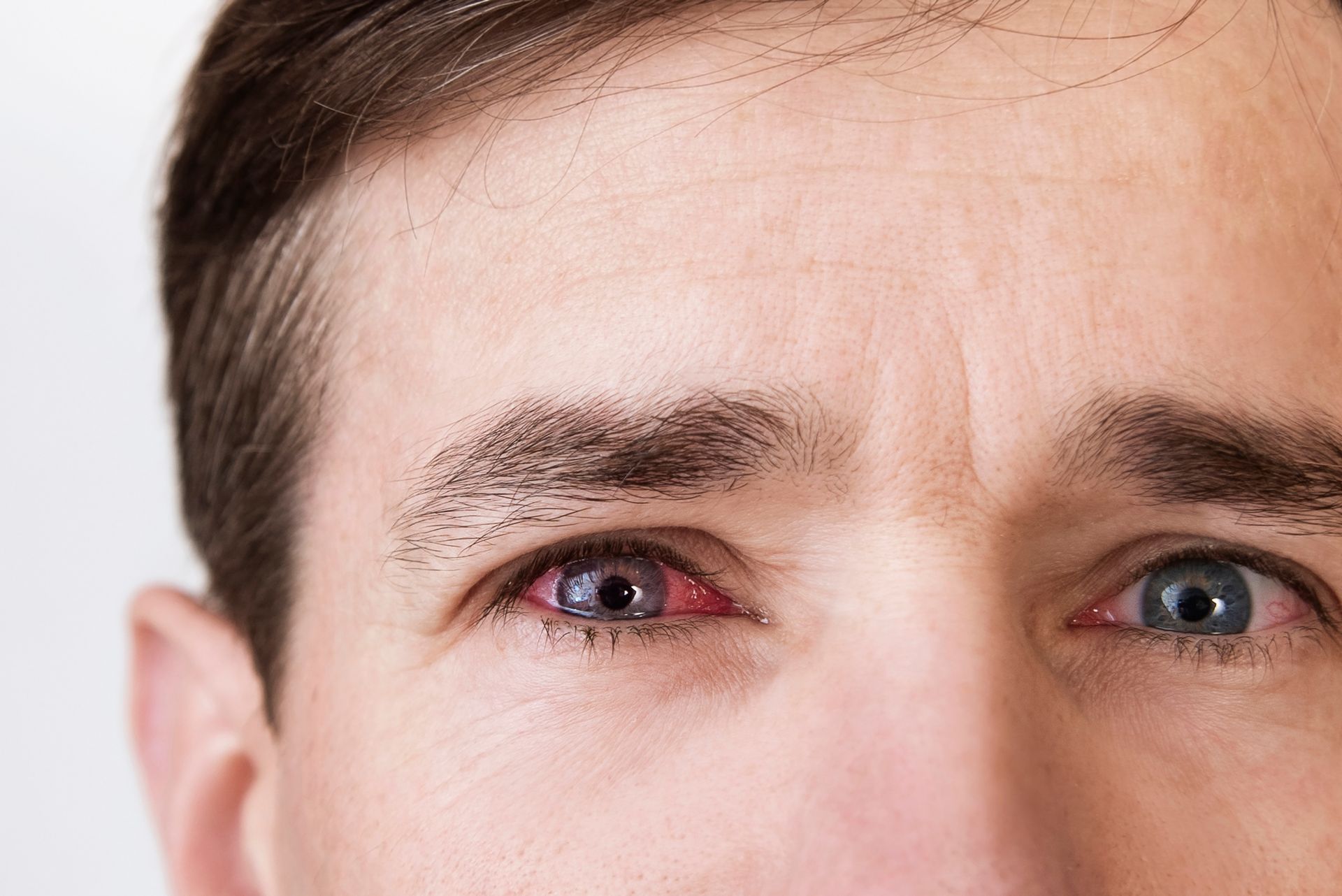 A man with red eyes. A man with red eyes.