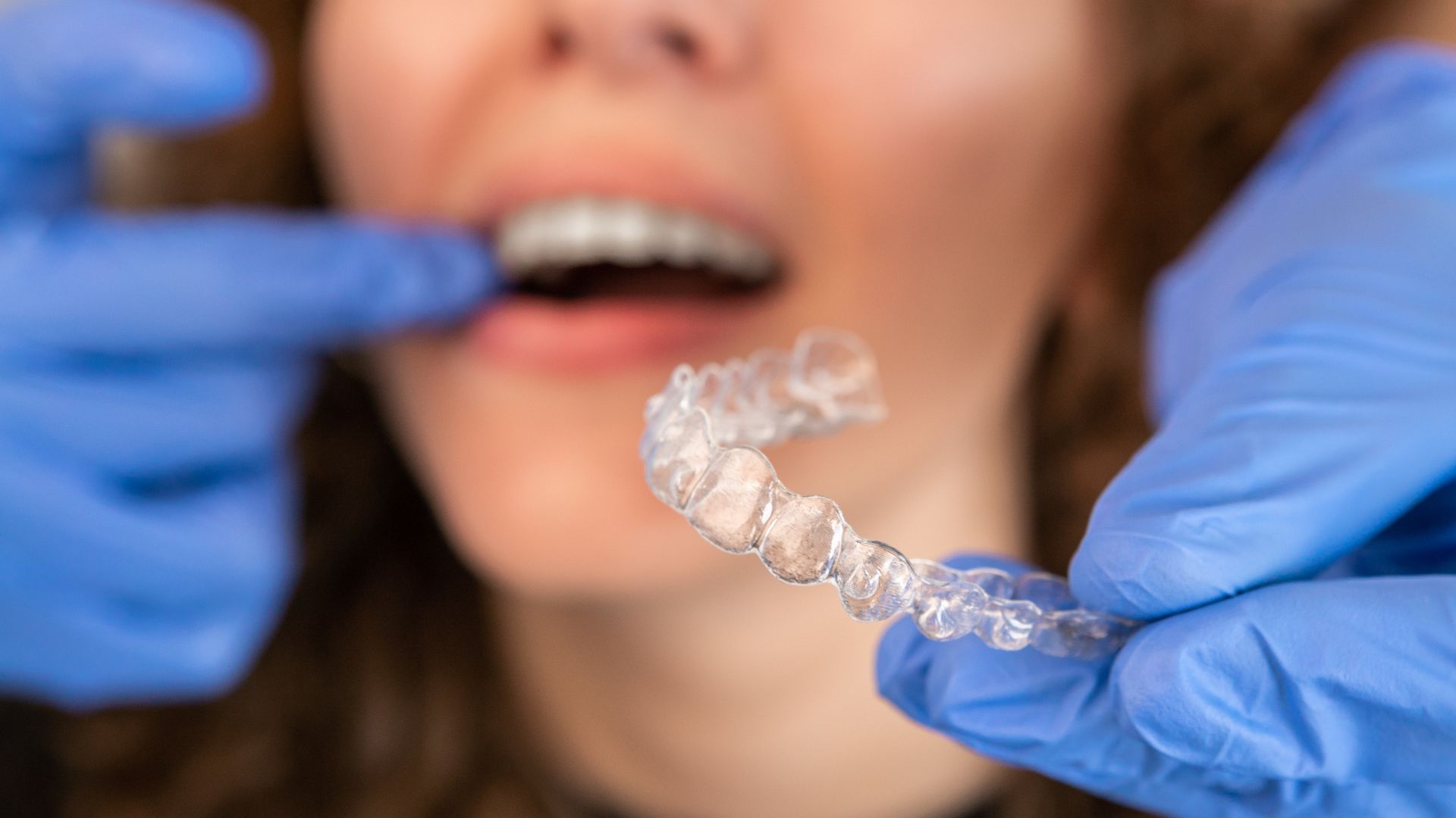 Teen girl smiling with new braces at orthodontist appointment with dental hygienist. Orthodontist doctor putting silicone invisible transparent braces on woman teeth.