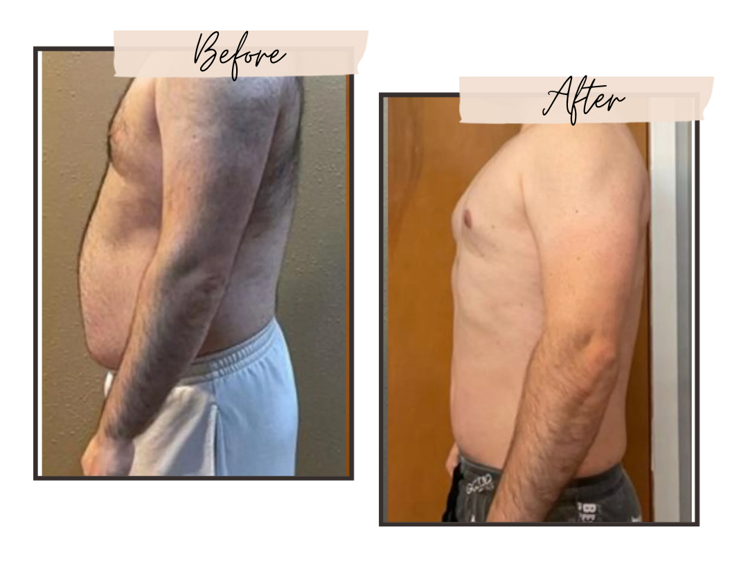 A before and after picture of a man 's torso.