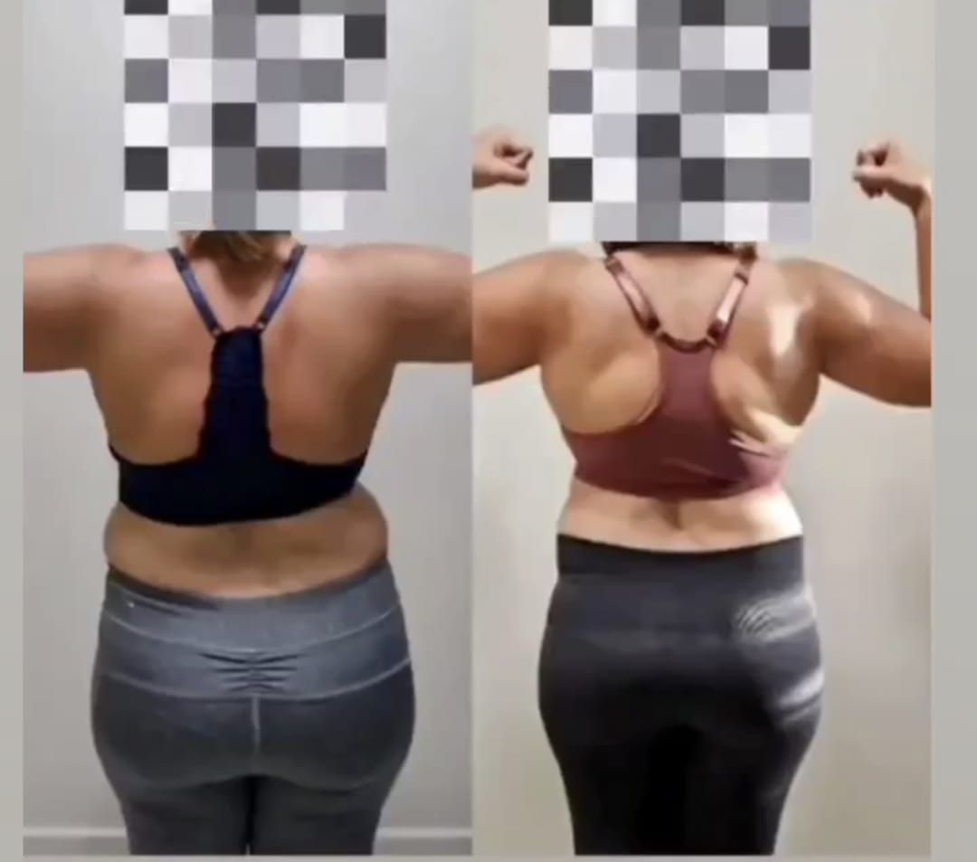 A before and after photo of a woman 's back