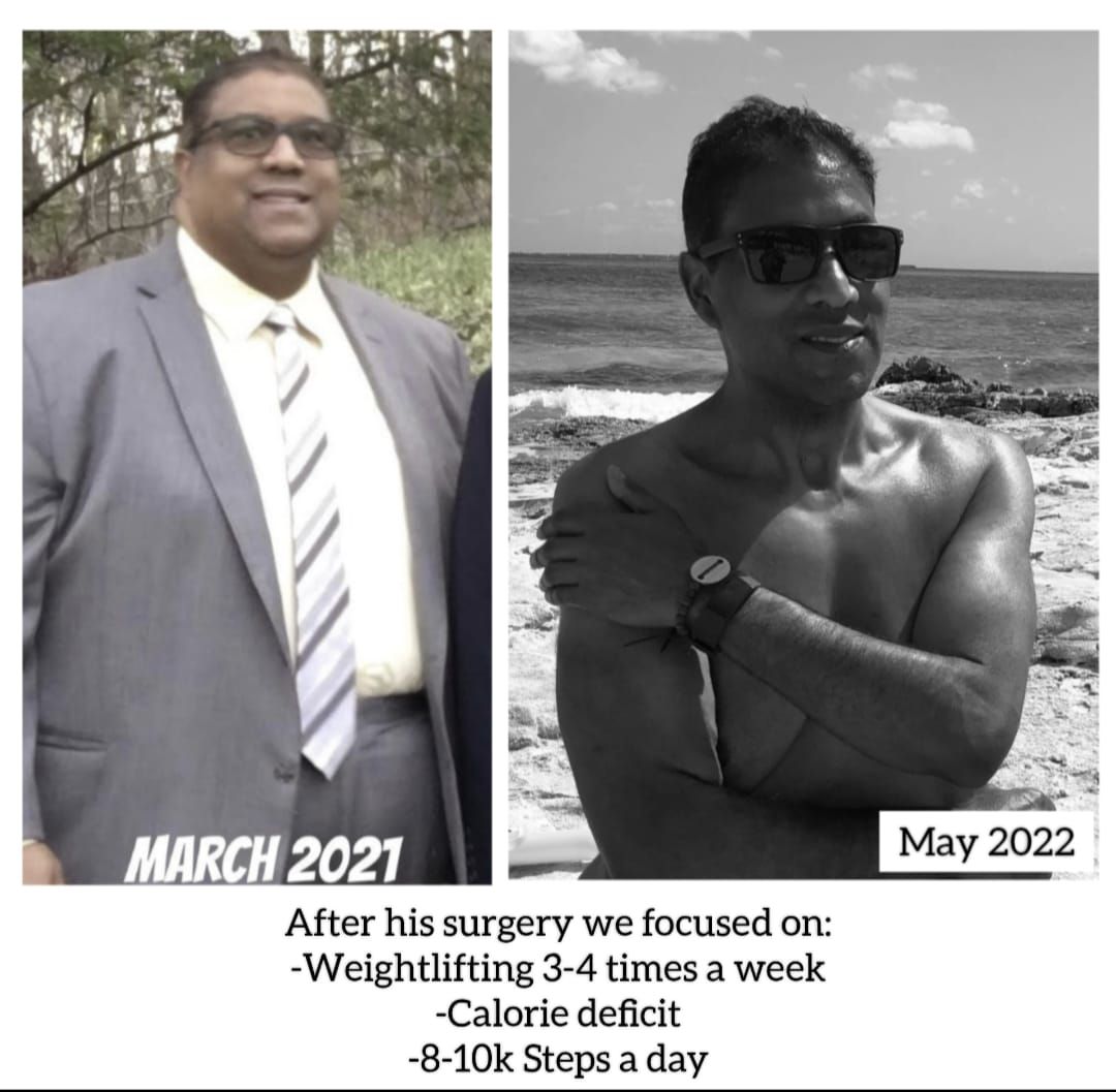 a picture of a man before and after his surgery