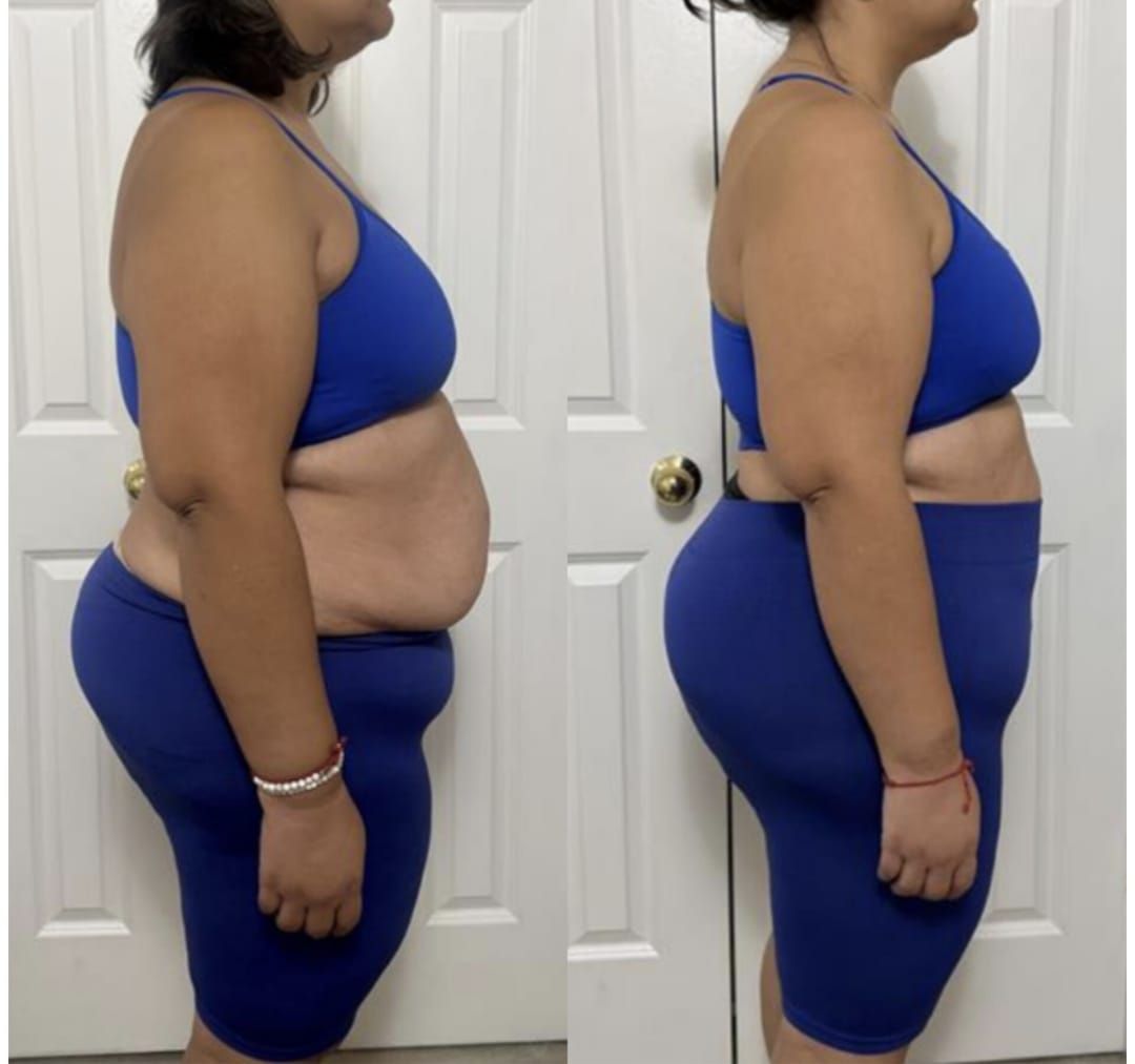 A before and after photo of a woman in a blue dress