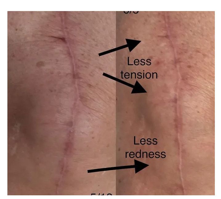 Knee Scars