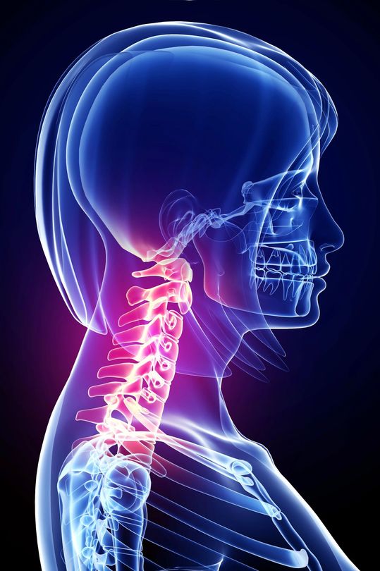 Profilo laterale in stile neon di una testa e di un collo umani con dolore cervicale evidenziato in rosso e rosa