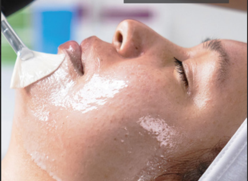 Skin Peels